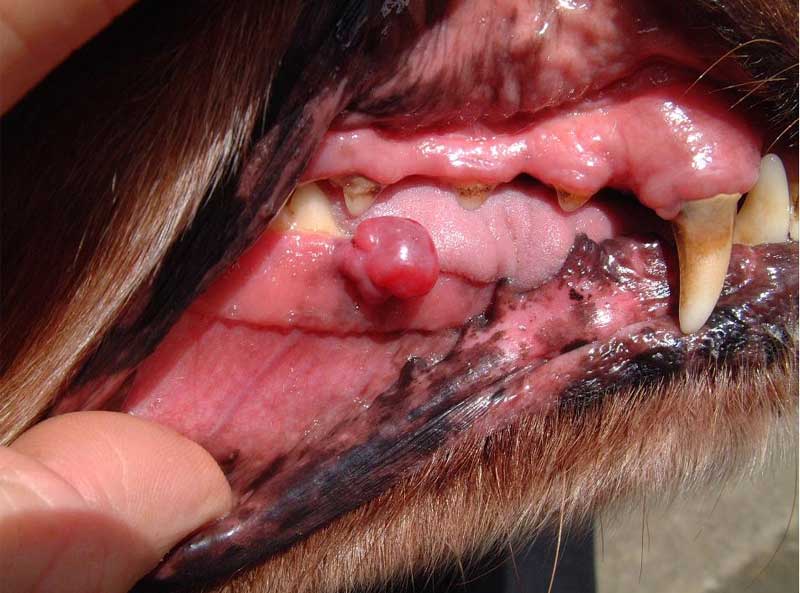 Oral Cancer Before Homeopathy